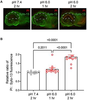 GPR68 Contributes to Persistent Acidosis-Induced Activation of AGC Kinases and Tyrosine Phosphorylation in Organotypic Hippocampal Slices